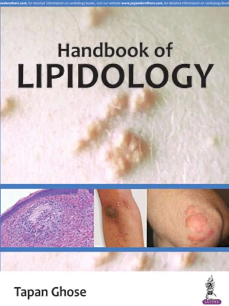 Handbook Of Lipidology by Ghose Tapan (Hardcover)