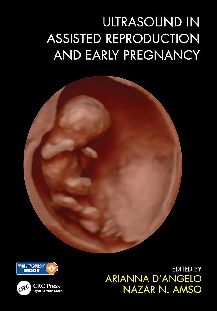 ULTRASOUND IN ASSISTED REPRODUCTION AND EARLY PREGNANCY by Arianna D Angelo
