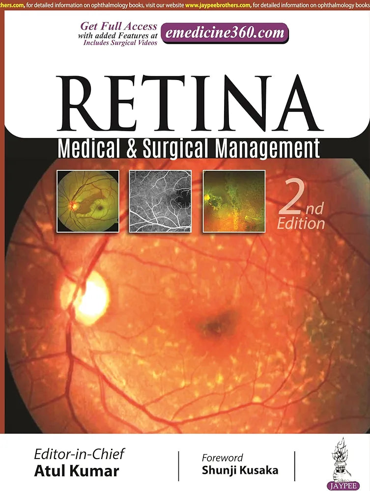 Retina: Medical & Surgical Management by Atul Kumar 2nd edition