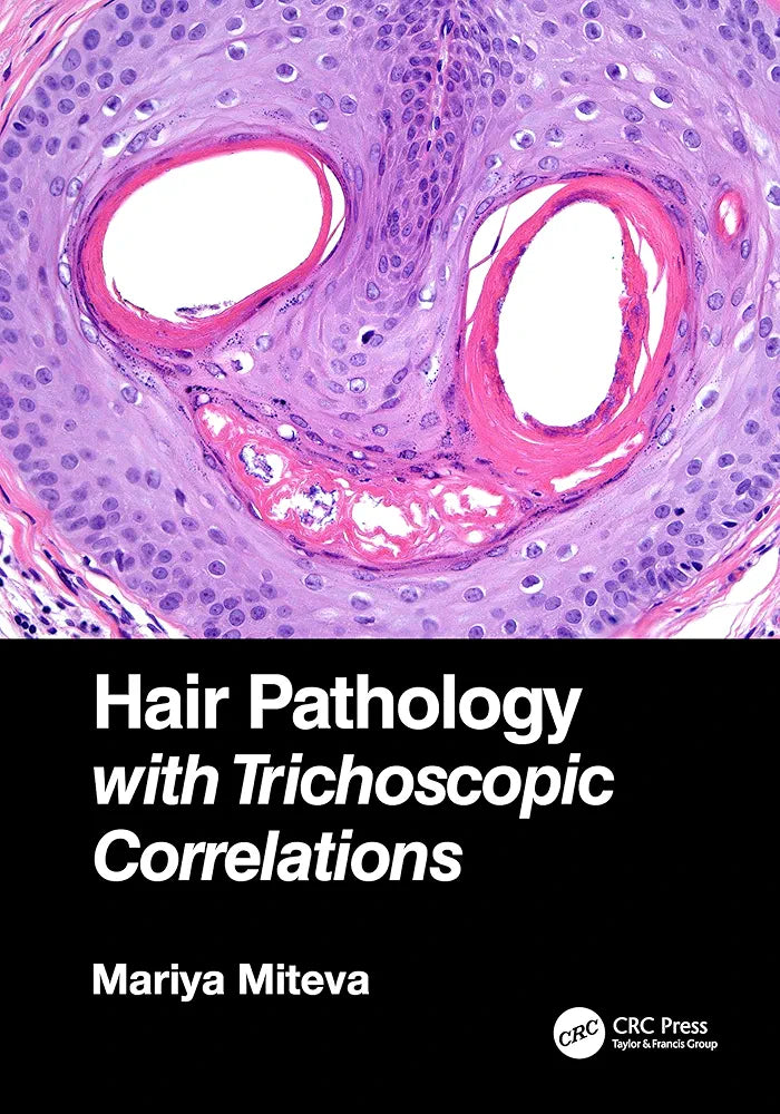 Hair Pathology with Trichoscopic Correlations by Mariya Miteva