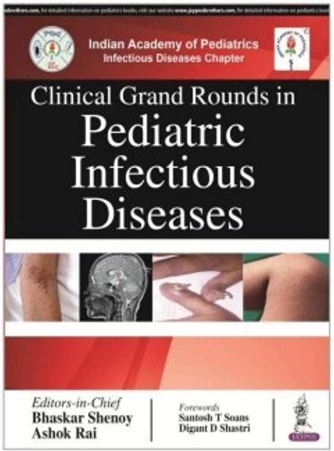 Clinical Grand Rounds In Pediatric Infectious Diseases by Bhaskar Shenoy , Ashok Rai