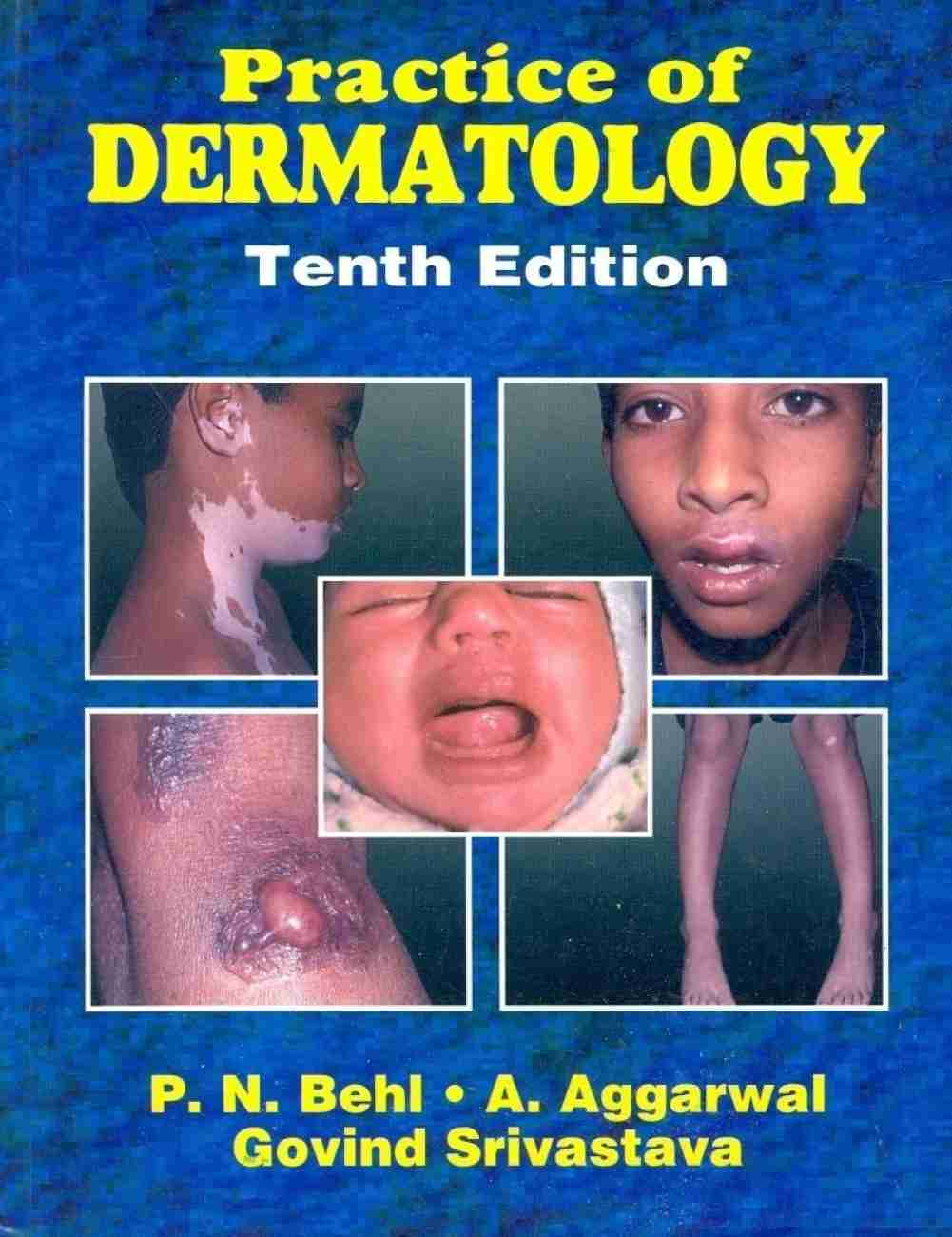 Practice Of Dermatology by P.N.Behl 10th edition