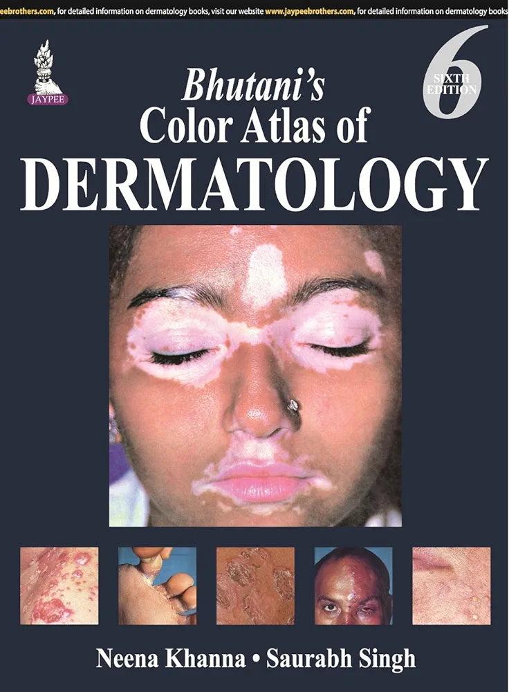 Bhutani’s Color Atlas of Dermatology by Neena Khanna 6th Edition