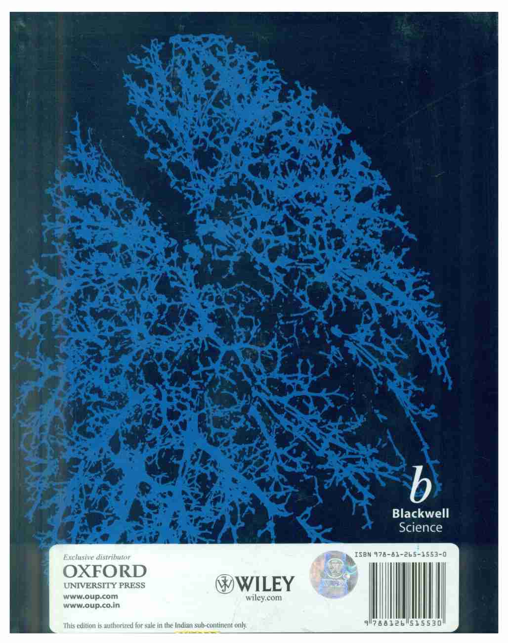 CROFTON & DOUGLAS RESPIRATORY DISEASES                     (Only Volume 2) hardcover                               by Anthony Seaton 5th edition