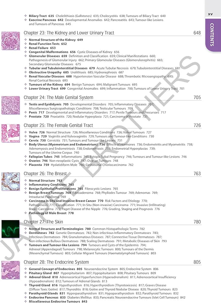 TEXTBOOK OF PATHOLOGY (FREE PATHOLOGY QUICK REVIEW) By Harsh Mohan 
9th Edition Revised Reprint