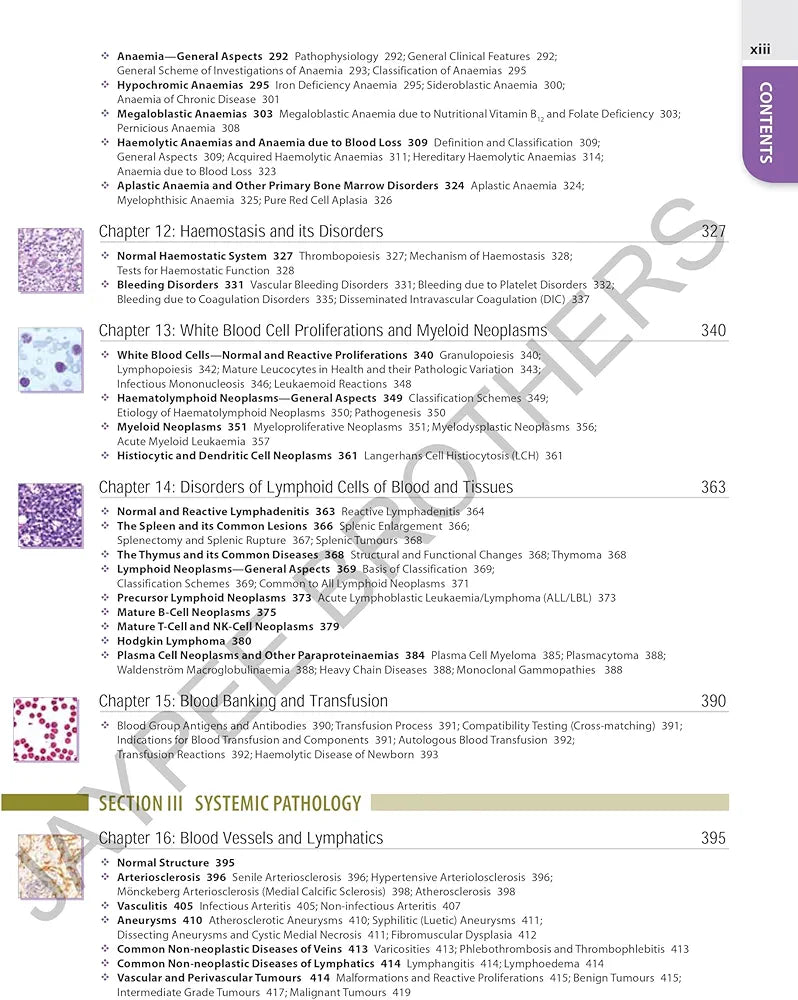 TEXTBOOK OF PATHOLOGY (FREE PATHOLOGY QUICK REVIEW) By Harsh Mohan 
9th Edition Revised Reprint